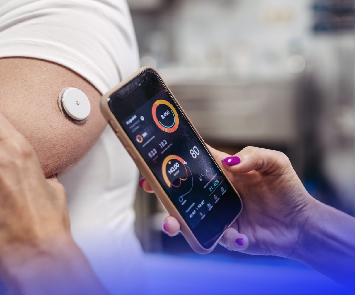 glucose monitoring app arm sensor A close-up of a person's arm with a glucose monitor sensor attached, while another hand holds a smartphone displaying a glucose monitoring app with health data.